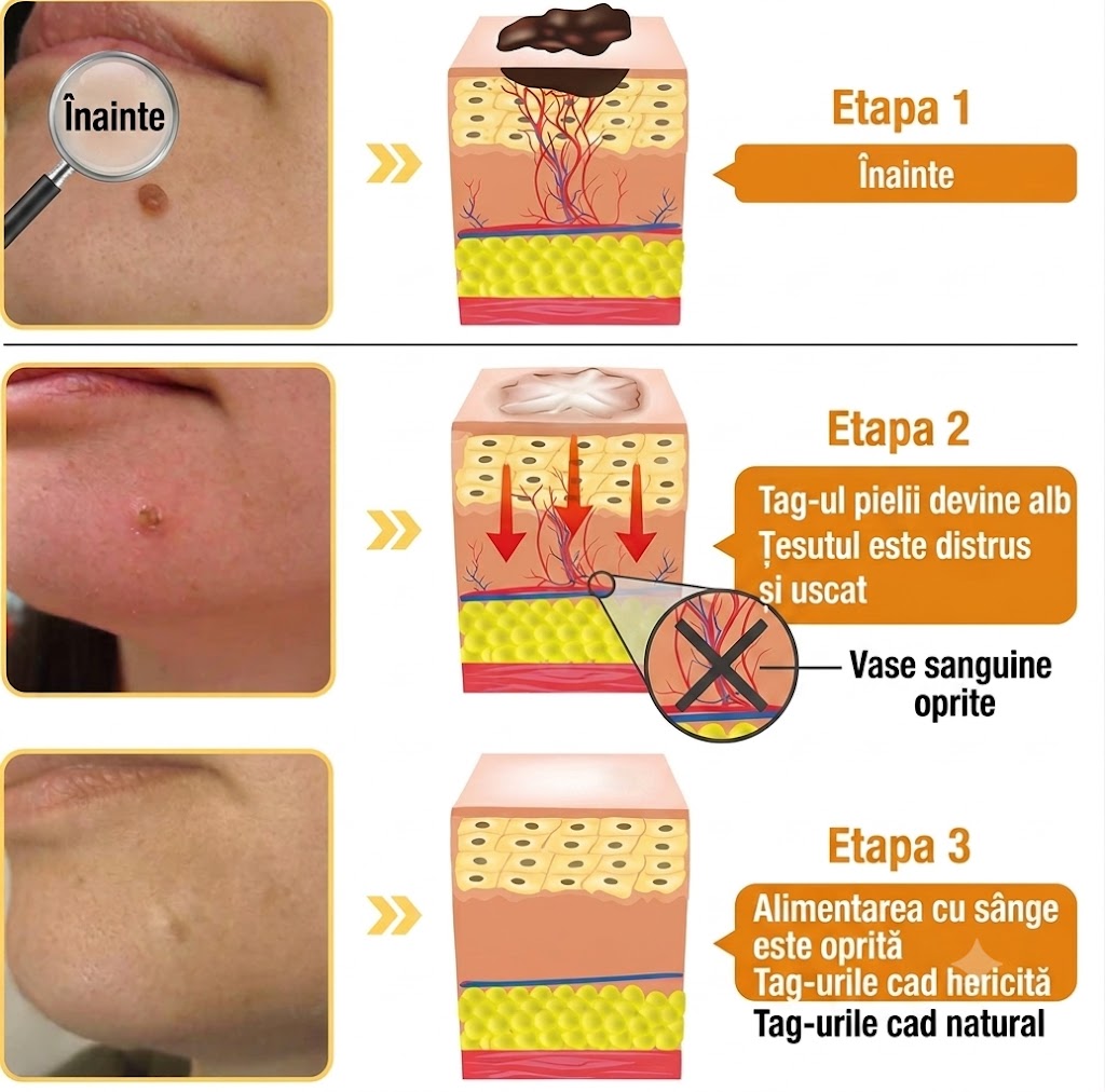 Spray Tratament cu Venin de Albine Pentru Imperfecțiunile Pielii