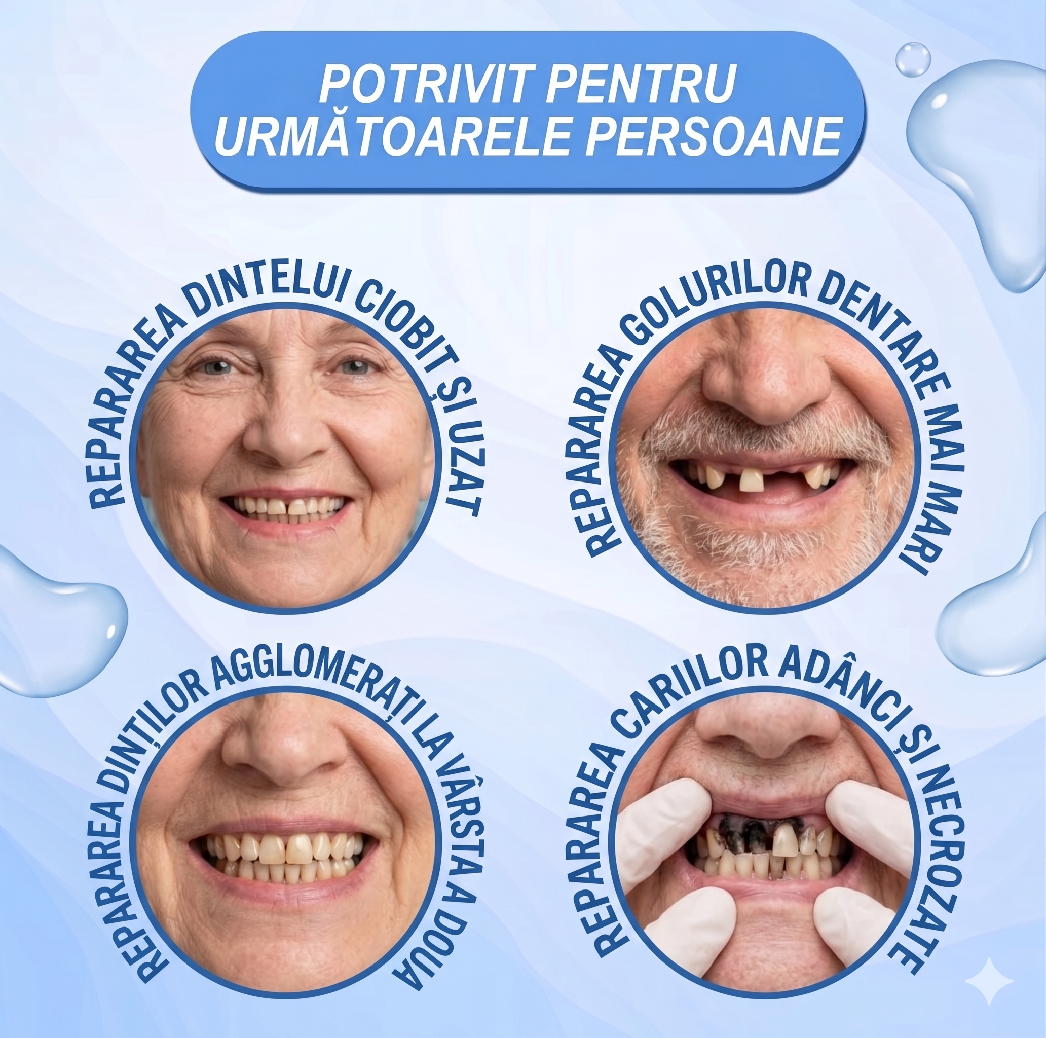 Kit de reparare a dinților cu aspect natural
