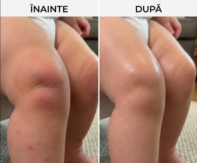 Genunchiere Protectoare pentru Bebeluși - Baby Protect