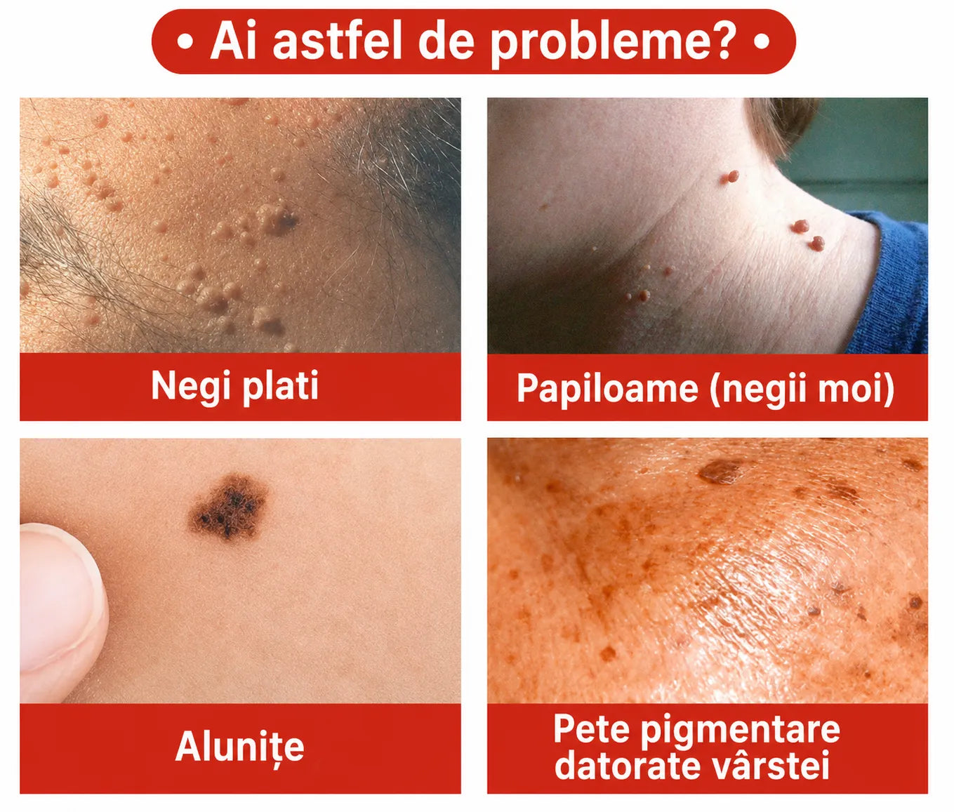 DermaLux - 144 plasturi pentru înlăturarea imperfecțiunilor